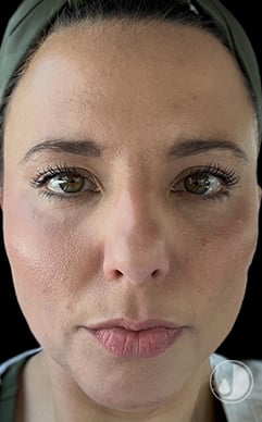 womans face