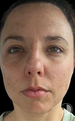 womans face