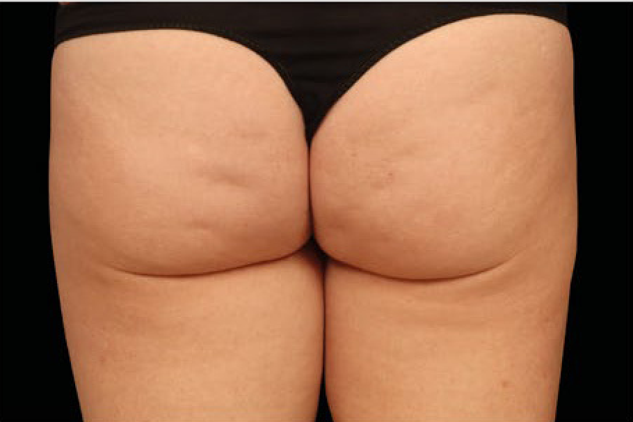 womans butt