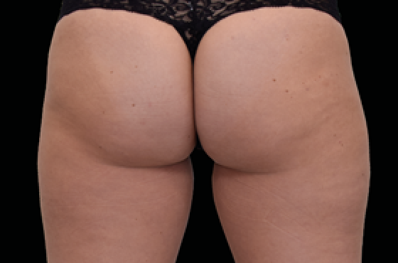 female butt