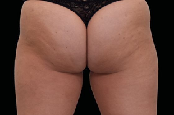 female butt