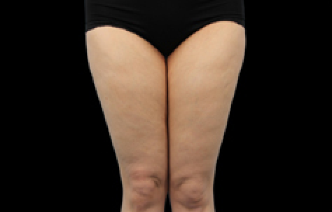 womans legs